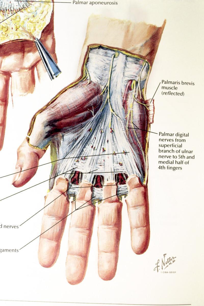 Diagram of Palmar Fascia- this is what is diseased in Dupuytren's Contracture.
